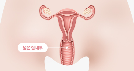 시술 전 이미지